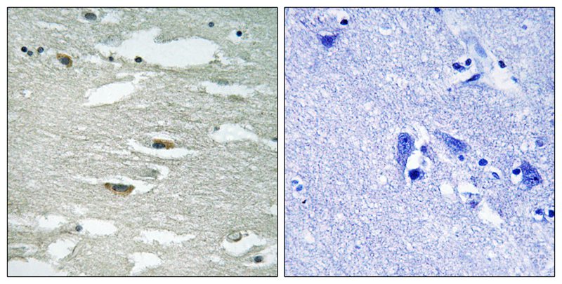 Anti-ILK (Phospho-Ser246) Antibody