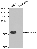 Anti-Histone H3K9me3 Antibody