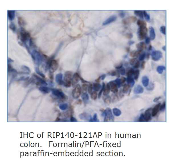 Anti-RIP140 Antibody ChIP grade