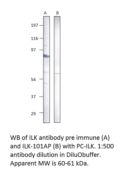 Anti-Integrin linked ILK Antibody