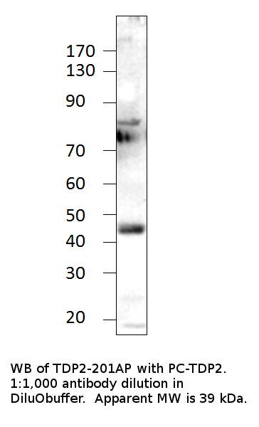 Anti-ETS1 Associated protein II Antibody