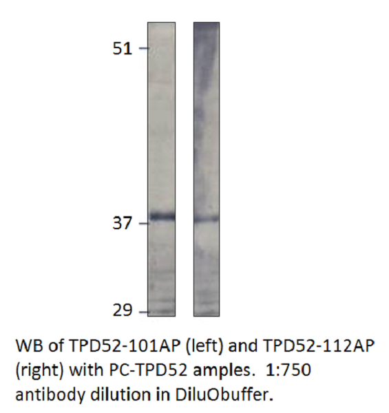 Anti-Prlz / TPD52 Antibody
