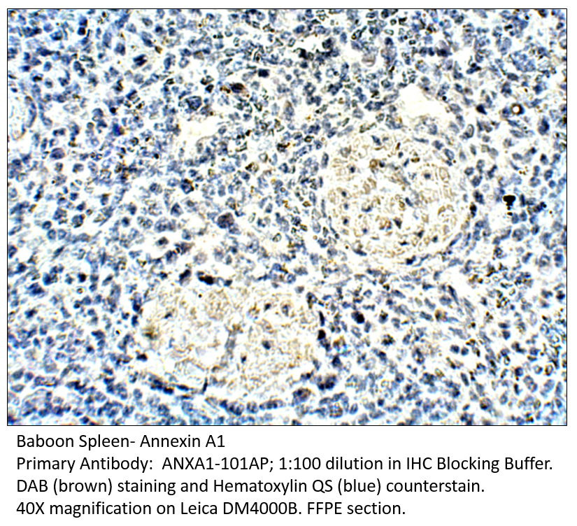 Anti-Annexin A1 Antibody