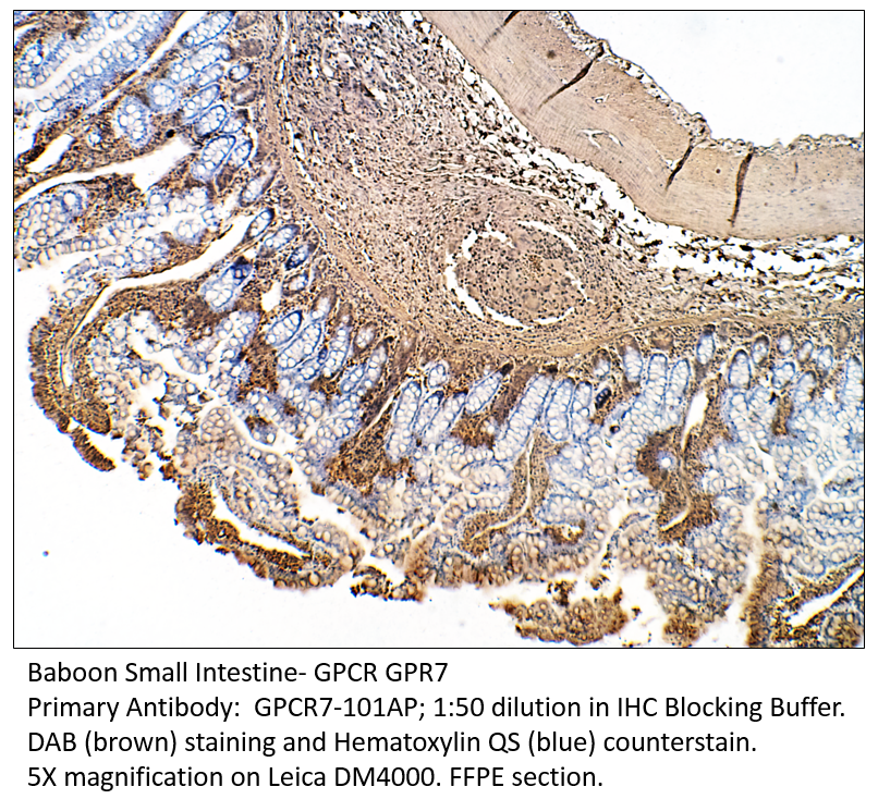 Anti-GPCR GPR7 Antibody