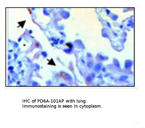 Anti-PDE6 Alpha Antibody