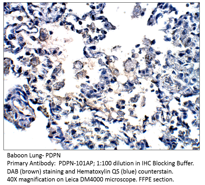 Anti-Podoplanin Antibody