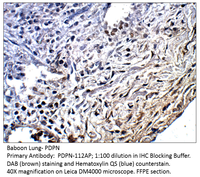 Anti-Podoplanin Antibody