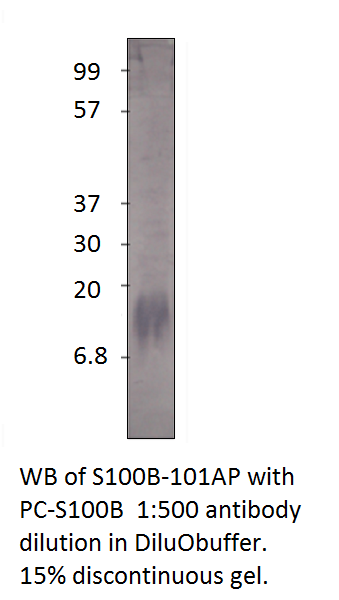 Anti-S100 beta Antibody