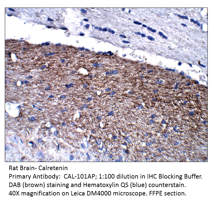 Anti-Calretinin Antibody