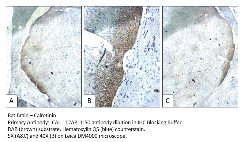 Anti-Calretinin Antibody