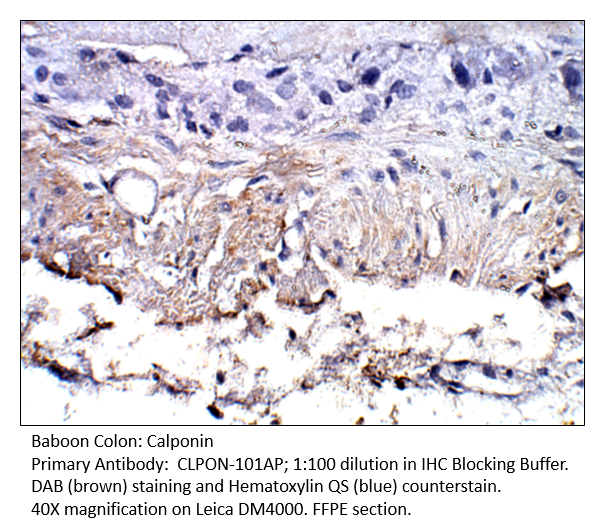 Anti-Calponin Antibody