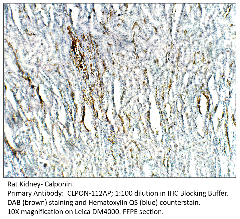 Anti-Calponin Antibody