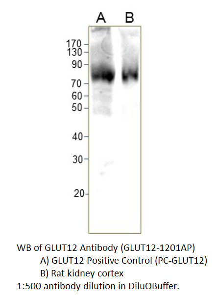 Anti-GLUT12 Antibody