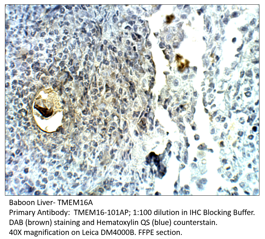 Anti-TMEM16A Antibody