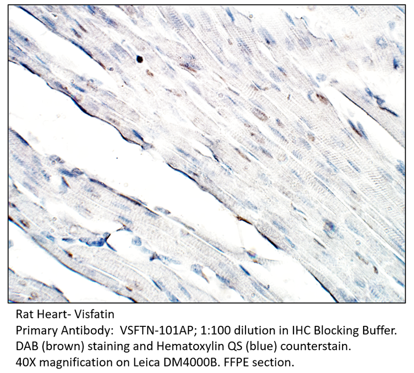 Anti-Visfatin Antibody