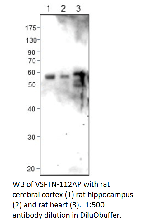 Anti-Visfatin Antibody