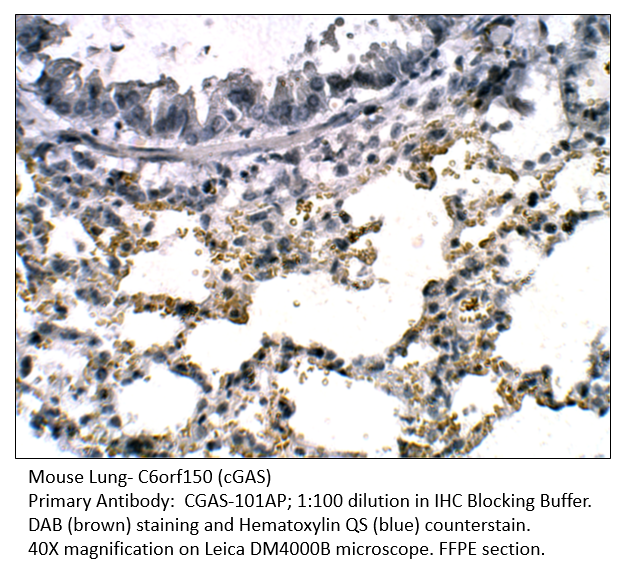 Anti-C6orf150 Antibody