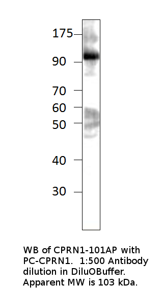 Anti-GPIP137 Antibody