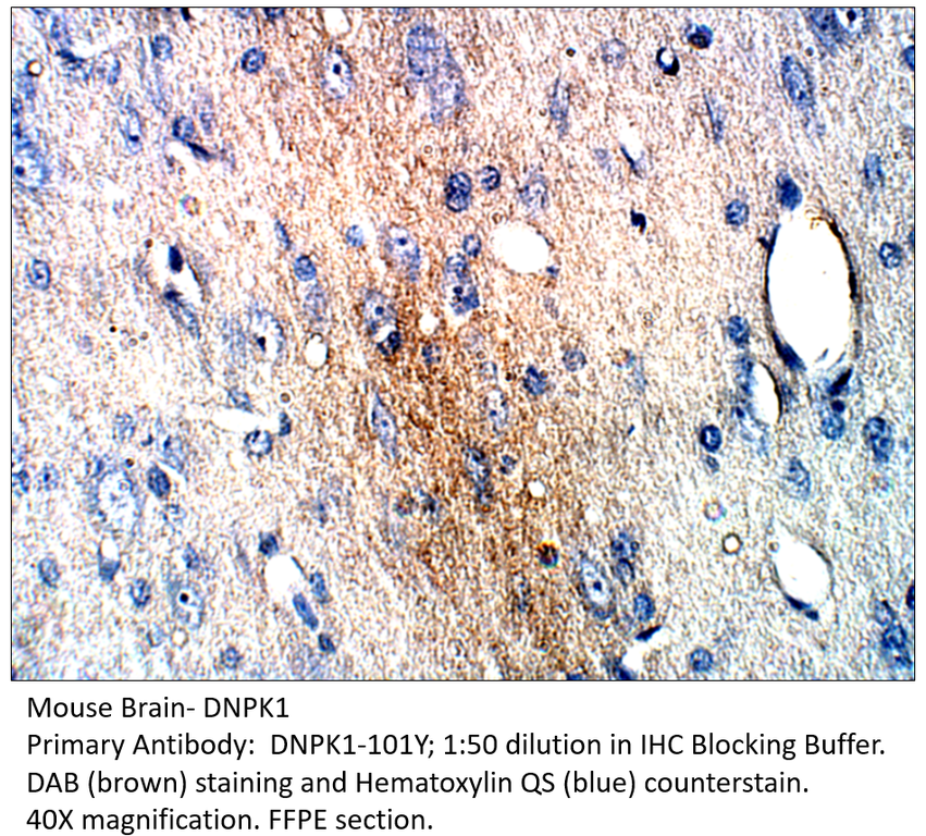 Anti-DNA PKcs Antibody