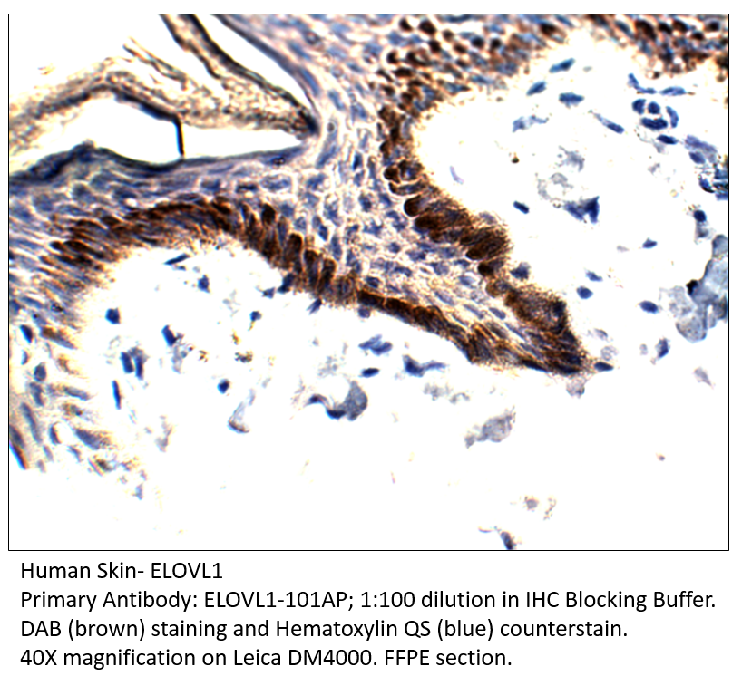 Anti-ELOVL1 Antibody