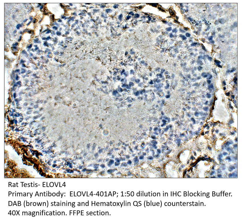 Anti-ELOVL4 Antibody