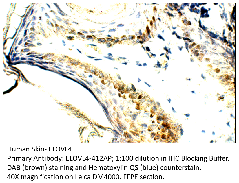 Anti-ELOVL4 Antibody