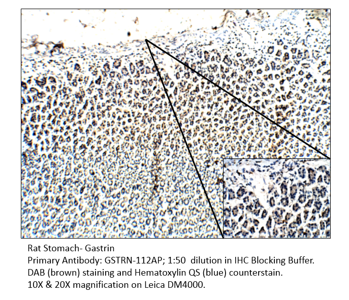 Anti-Gastrin Antibody