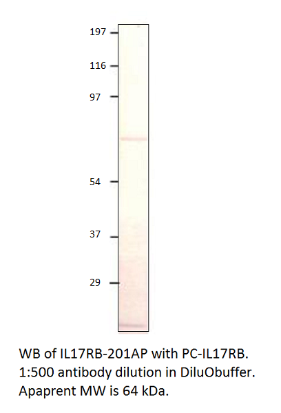 Anti-IL17RB Antibody