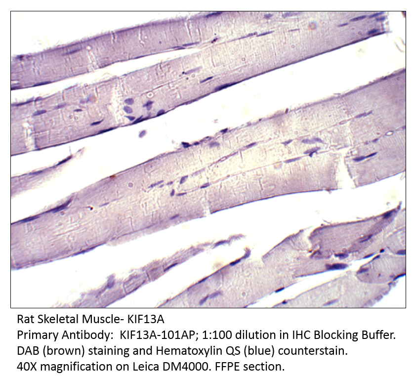 Anti-KIF13A Antibody