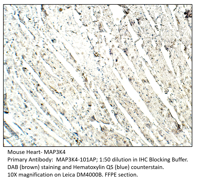 Anti-MAP3K4 Antibody