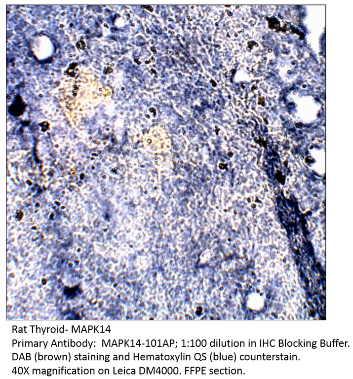 Anti-MAPK14 Antibody