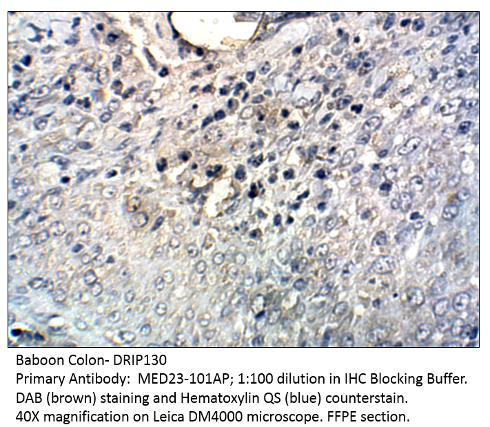 Anti-DRIP130 Antibody