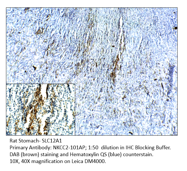 Anti-SLC12A1 Antibody