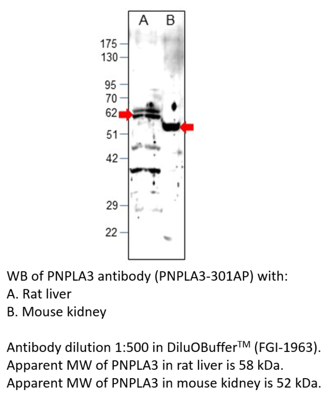 Anti-PNPLA3 Antibody