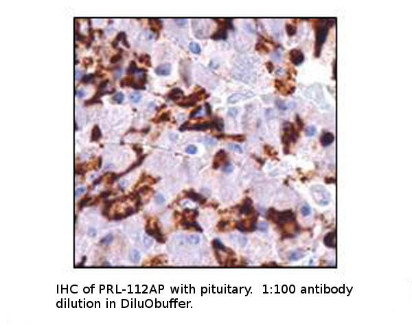 Anti-Prolactin Antibody