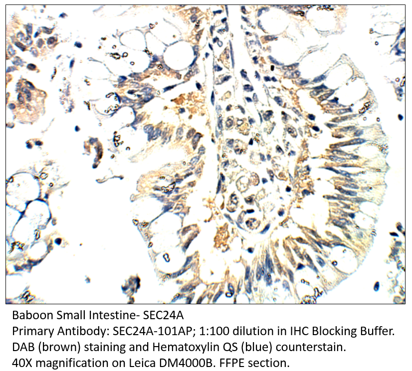 Anti-SEC24A Antibody