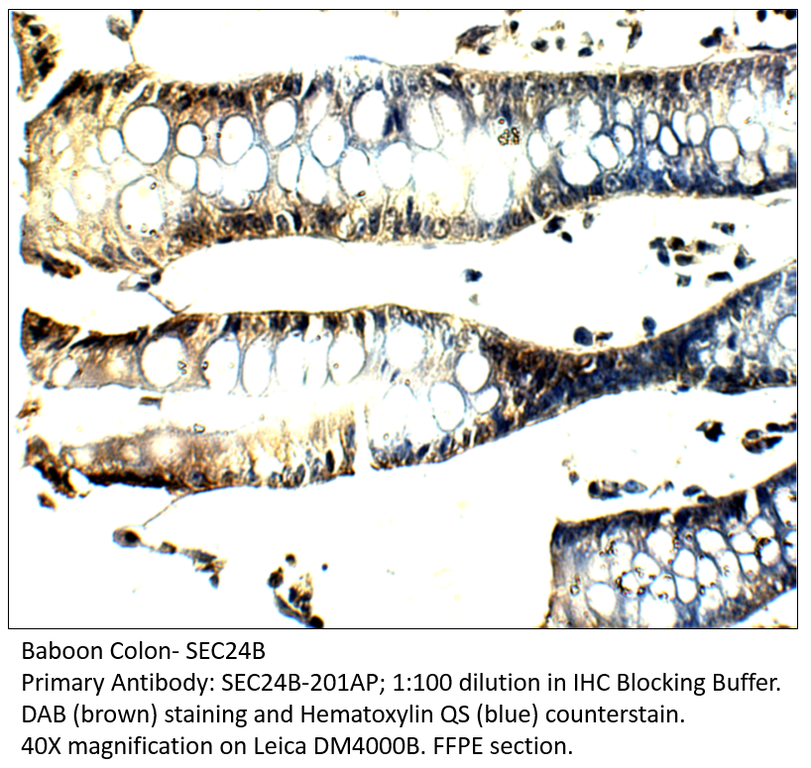 Anti-SEC24B Antibody