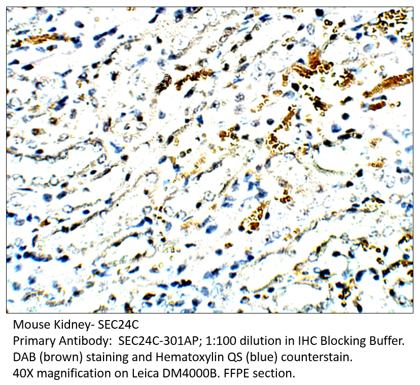 Anti-SEC24C Antibody