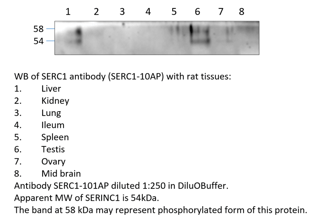 Anti-SERINC1 Antibody