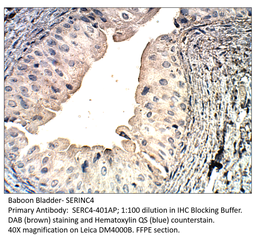 Anti-SERINC4 Antibody