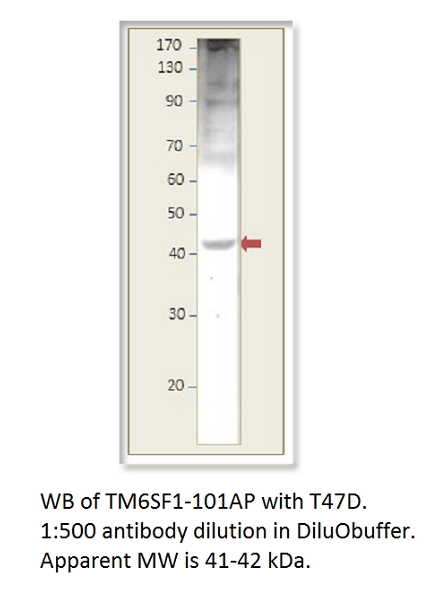 Anti-TM6SF1 Antibody