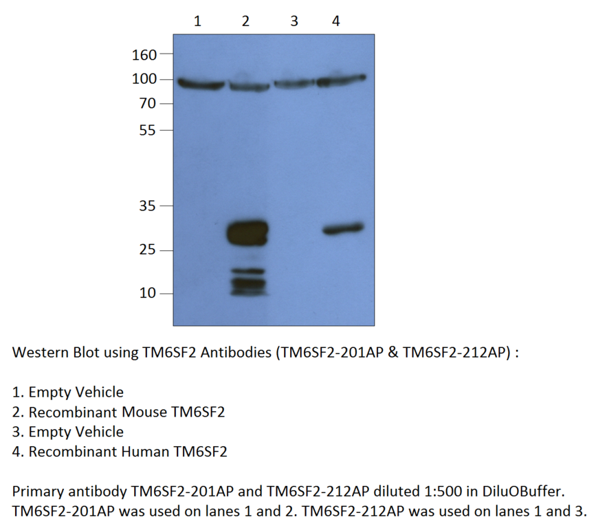 Anti-TM6SF2 Antibody