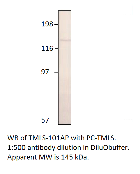 Anti-Timeless Antibody