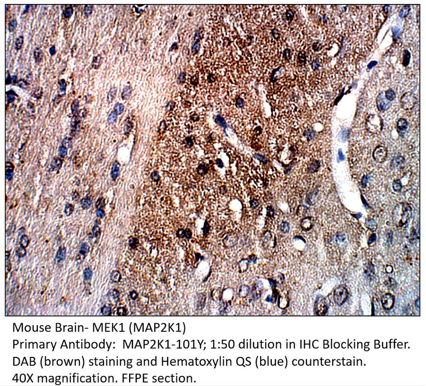 Anti-MAP2K1 Antibody