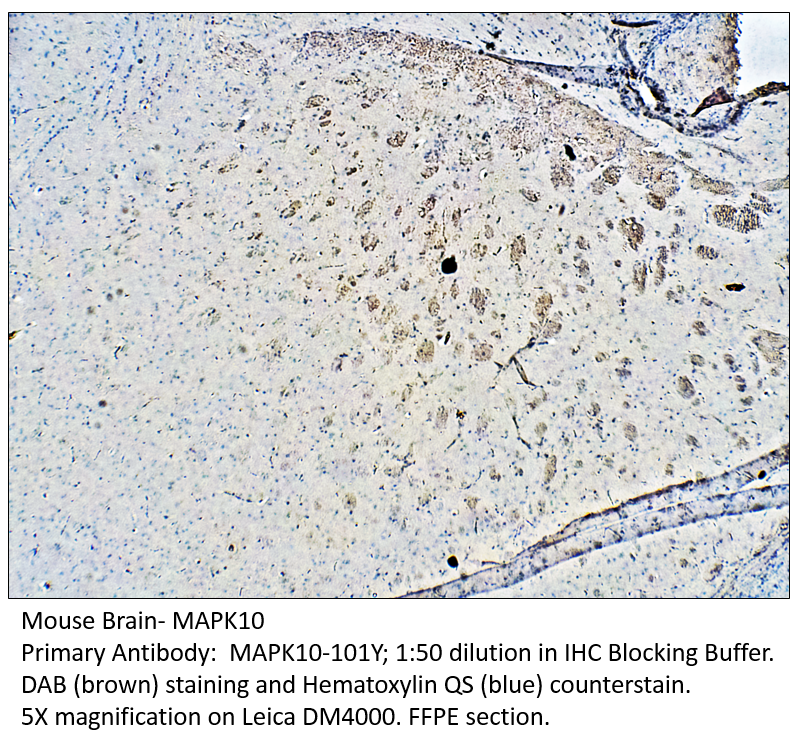 Anti-MAPK10 Antibody