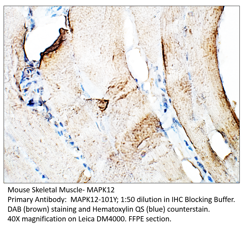 Anti-MAPK12 Antibody