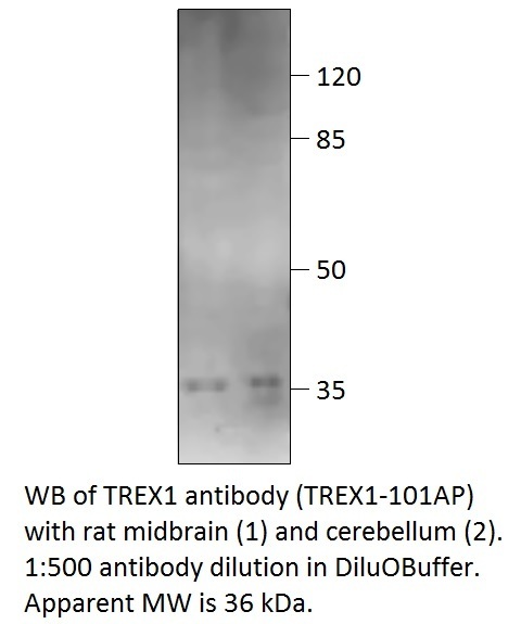 Anti-TREX1 Antibody