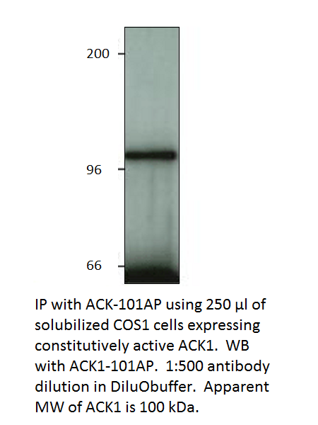 ACK1 Blocking Peptide