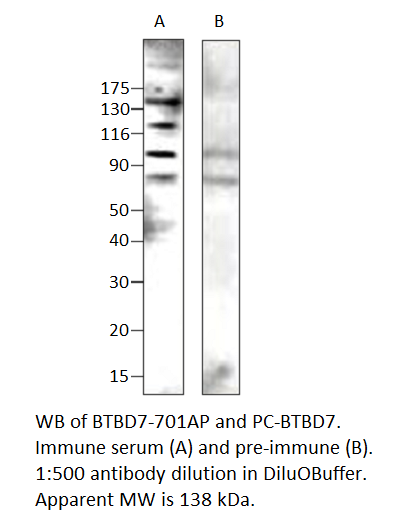 BTB/POZ domain-containing protein 7 Positive Control