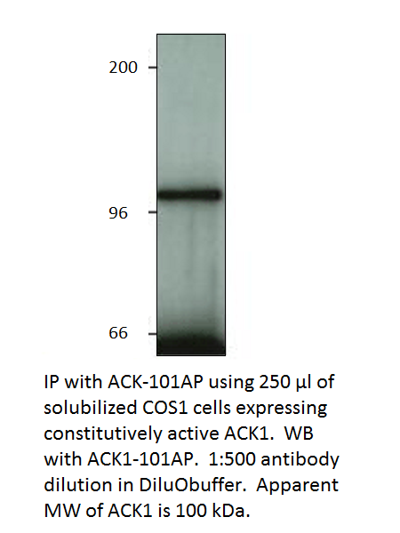 ACK1 Positive Control